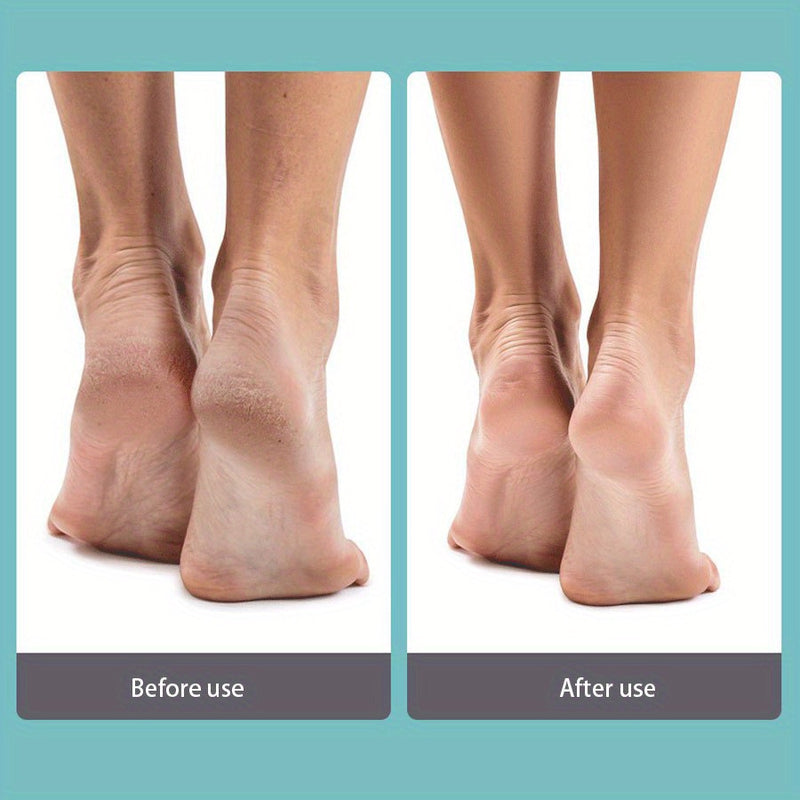 Lima para callos de acero inoxidable, herramienta de pedicura para piel muerta y talones ásperos, recortador de callos sin perfume no eléctrico - Duradero y portátil
