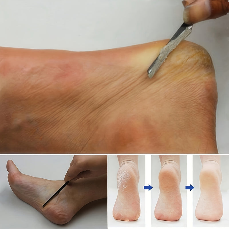 2 Piezas de Raspadores y Removedores de Pedicura de Acero Inoxidable Resistentes - Herramientas Profesionales con Cuchillas Afiladas, Empuñadura Antideslizante para Hogar, Salón o Spa - Sin Batería Necesaria, Fácil de Limpiar y Guardar