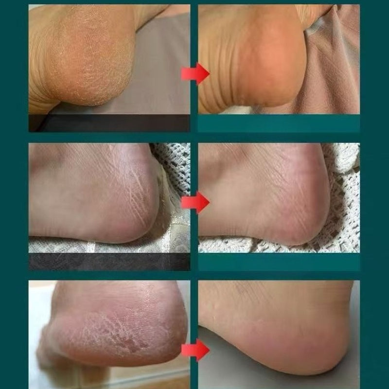 Un limpiador de pies de doble cara de acero inoxidable diseñado para áreas gruesas y delgadas, exfoliante y adecuado para piel seca y húmeda, ayuda a eliminar y lograr pies suaves, ideal para uso profesional de pedicura | Remover | Limpiador | Lijador de