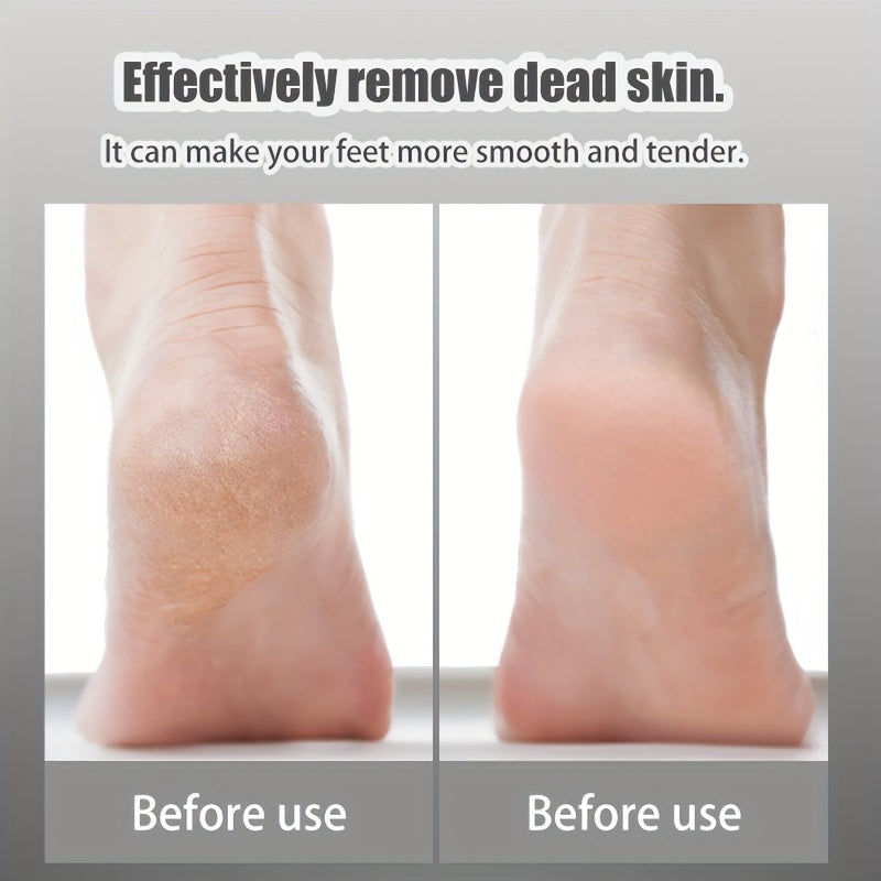 Juego de Cuidado del Pie de 8 piezas, Perfecto para Eliminar Piel Muerta y Herramienta Profesional de Pedicura, Dispositivo de Exfoliación Manual - Herramientas Seguras y Eficientes para el Cuidado del Pie Ideales para Uso en Casa