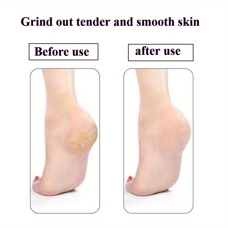 Removedor y Lijador de Pies Manual - Sin Necesidad de Electricidad, Lima Portátil para Uñas Muertas y Encarnadas Beige Claro - Cuidado de Pedicura Práctico para Viajes, Construcción en Plástico Duradero - Ideal para Hogar o Salón, Regalo Perfecto para Am
