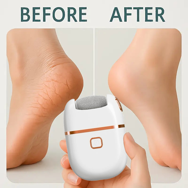 FEIYBA Eliminador Eléctrico y Lijadora de Pies - Lima de Uñas con Carga USB, 2 Velocidades (Rápido/Lento), 3 Cabezales Reemplazables, Herramienta Inalámbrica para Talones Agrietados, Manos y Pies - Diseño Blanco y Dorado, Dispositivo Profesional de Pedic