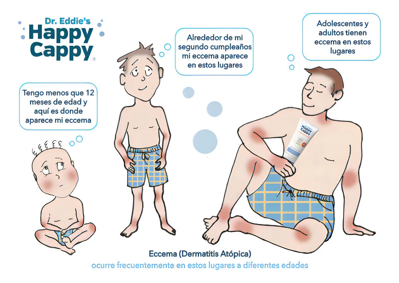 Shampoo Medicado Para Bebe Trata La Caspa Y Dermatitis 8oz