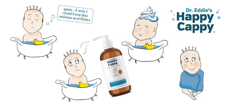 Shampoo Medicado Para Bebe Trata La Caspa Y Dermatitis 8oz