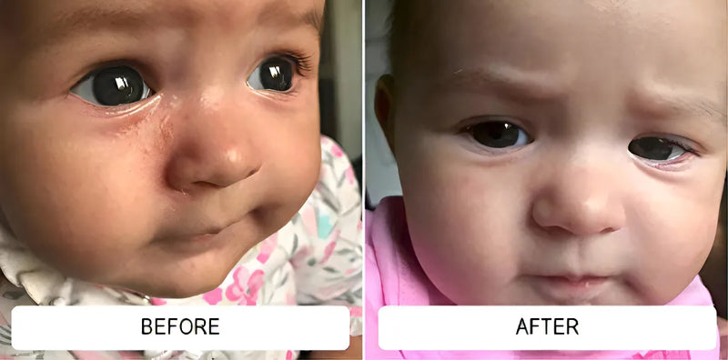 Shampoo Medicado Para Bebe Trata La Caspa Y Dermatitis 8oz