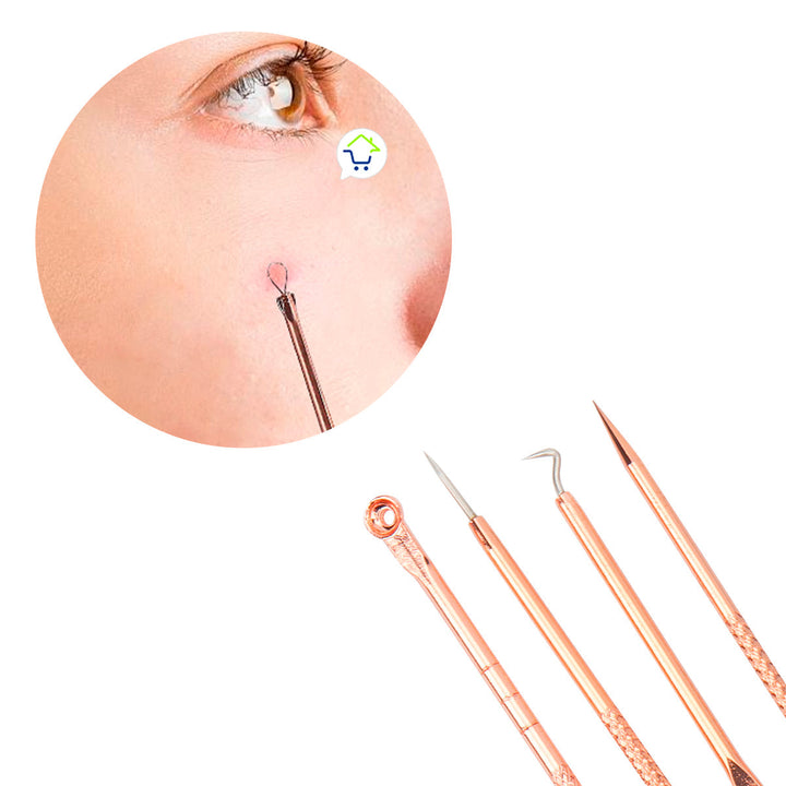 Kit Removedor de Espinillas ESP01