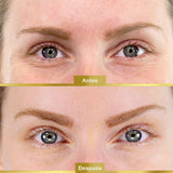 Mascarilla Ojos Colágeno Anti edad Hidrata Suaviza RF DE0010