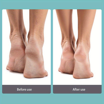 Lima para callos de acero inoxidable, herramienta de pedicura para piel muerta y talones ásperos, recortador de callos sin perfume no eléctrico - Duradero y portátil