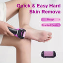 XUMTOM Lijadora eléctrica de pies - Lijadora de pies portátil con batería seca, con paño abrasivo giratorio, exfoliación sin dolor para la piel dura, eliminación de callos, mango antideslizante, ideal para uso en casa y viajes, cuidado de pies en viajes