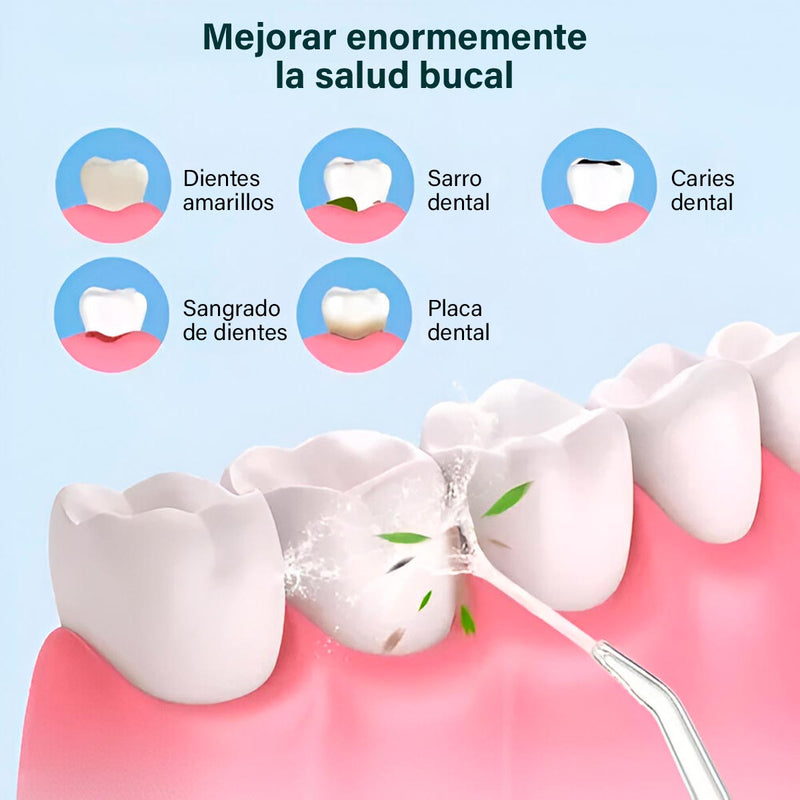 Irrigador Bucal Oral + 4 Boquillas Limpieza Dental Recargable USB KRD-1948