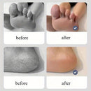 Un limpiador de pies de doble cara de acero inoxidable diseñado para áreas gruesas y delgadas, exfoliante y adecuado para piel seca y húmeda, ayuda a eliminar y lograr pies suaves, ideal para uso profesional de pedicura | Remover | Limpiador | Lijador de