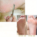 Herramienta de Cuidado de Pies de Acero Inoxidable, Removedor de Cutículas de Acero Inoxidable, Cortauñas para Dedos del Pie, Accesorios Sin Perfume para Pies Suaves