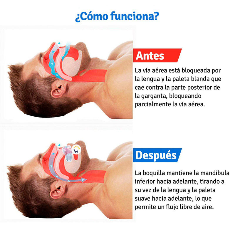 Protector De Dientes Anti ronquido y Bruxismo Moldeable 8035