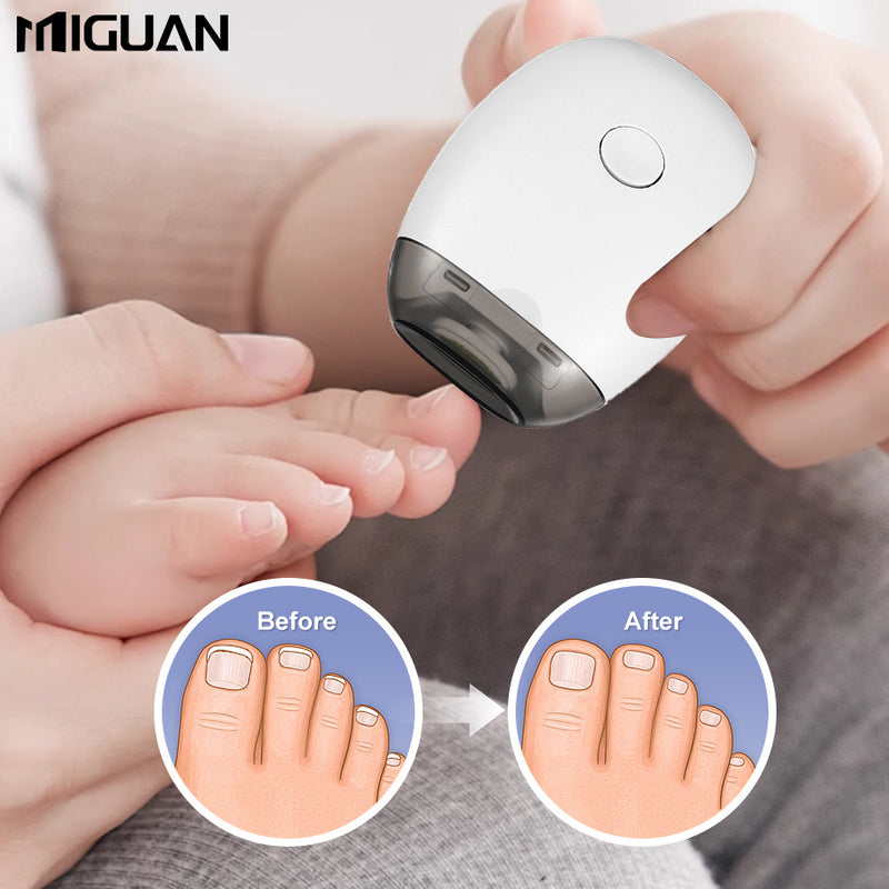 Portátil Cortaúñas Eléctrico, Herramienta de Manicura con 3 Velocidades Ajustables, Batería de Litio Recargable USB, Iluminación Luminosa y Bajo Ruido