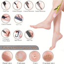 Kit Profesional de Spa para Pies, Cuidado de 10 en 30.48 cm, Juego de Acero Inoxidable para el Cuidado de los Pies, Removedor de Piel Muerta y Pedicura, Conjunto de Lima para Pies con Quitapelotas (Negro)