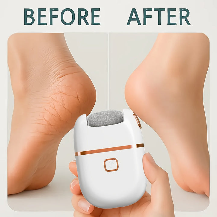 Lijadora eléctrica FEIYBA con 2 cabezales de lijado - Cargador USB, removida y luz muerta beige, diseño ergonómico para uso doméstico, herramienta de belleza para pies viajera para adultos y familia, removida de pies, rutina de cuidado de la piel, diseño