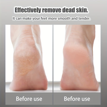 Juego de Cuidado del Pie de 8 piezas, Perfecto para Eliminar Piel Muerta y Herramienta Profesional de Pedicura, Dispositivo de Exfoliación Manual - Herramientas Seguras y Eficientes para el Cuidado del Pie Ideales para Uso en Casa