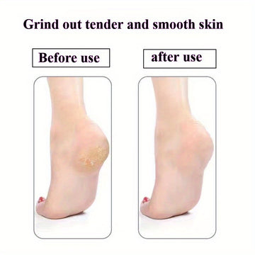 Removedor y Lijador de Pies Manual - Sin Necesidad de Electricidad, Lima Portátil para Uñas Muertas y Encarnadas Beige Claro - Cuidado de Pedicura Práctico para Viajes, Construcción en Plástico Duradero - Ideal para Hogar o Salón, Regalo Perfecto para Am
