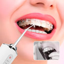 Irrigador Bucal Oral + 4 Boquillas Limpieza Dental Recargable USB KRD-1948