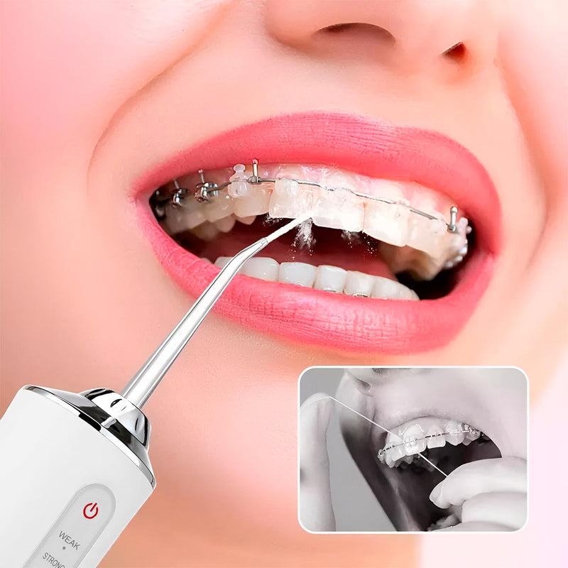 Irrigador Bucal Oral + 4 Boquillas Limpieza Dental Recargable USB KRD-1948