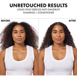 Champú Anticaspa Dercos Sulfuro De Selenio 200ml