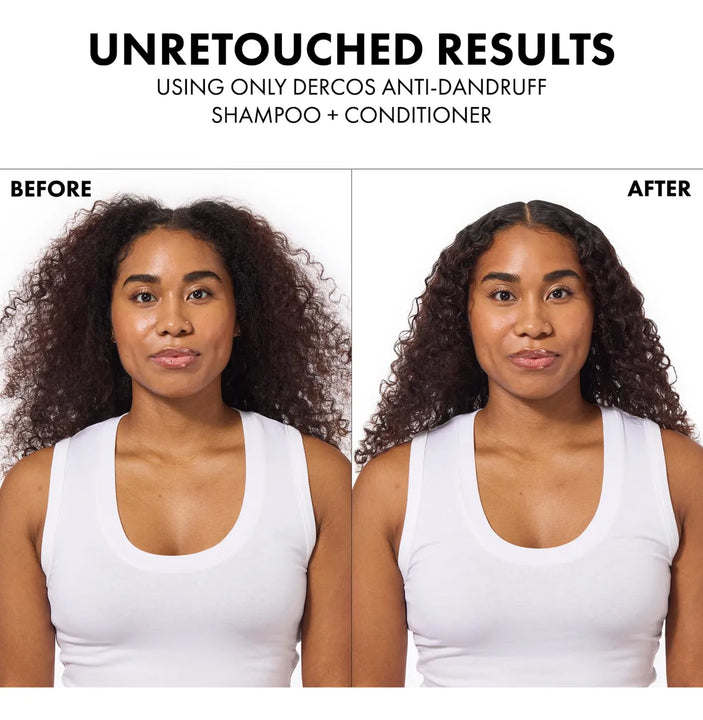 Champú Anticaspa Dercos Sulfuro De Selenio 200ml