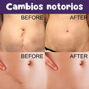 Parche cinta Silicona Eliminación de Cicatrices Adhesivo