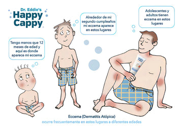Shampoo Medicado Para Bebe Trata La Caspa Y Dermatitis 8oz
