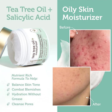 Crema Hidratante Era Organics Tea Tree Para Piel Grasa 7x
