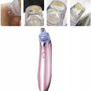 Extractor Facial De Espinillas Y Puntos Negros Eléctrico