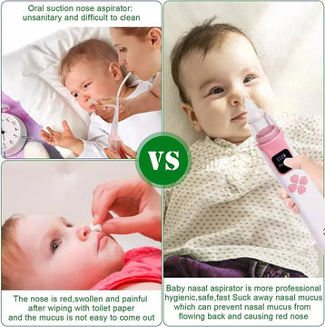 Aspirador Nasal Electrico Recargable Musical Para Bebe Segun Disponibilidad