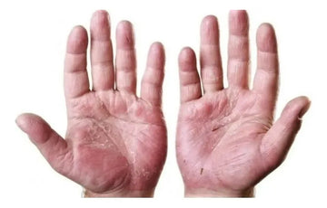 Hinode Hands Crema de manos Aloe Vera pack 3