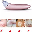 Extractor Facial De Espinillas Y Puntos Negros Eléctrico