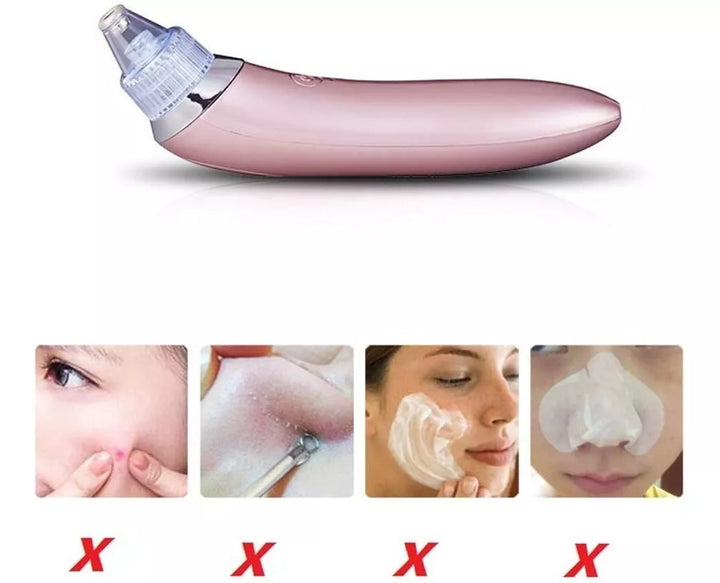 Extractor Facial De Espinillas Y Puntos Negros Eléctrico