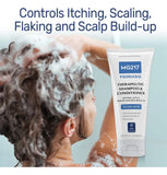 Alivia Tu Psoriasis Con El Tratamiento Natural 3% Acido Sali