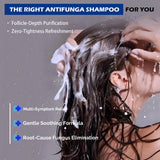 Champú Antifúngico Para Dermatitis Seborreica Y Caspa