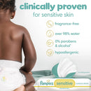 Pampers Sensitive: Protege Suavemente La Piel De Tu Bebe