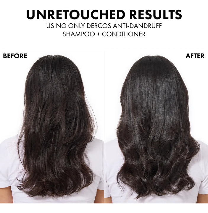 Champú Anticaspa Dercos Sulfuro De Selenio 200ml