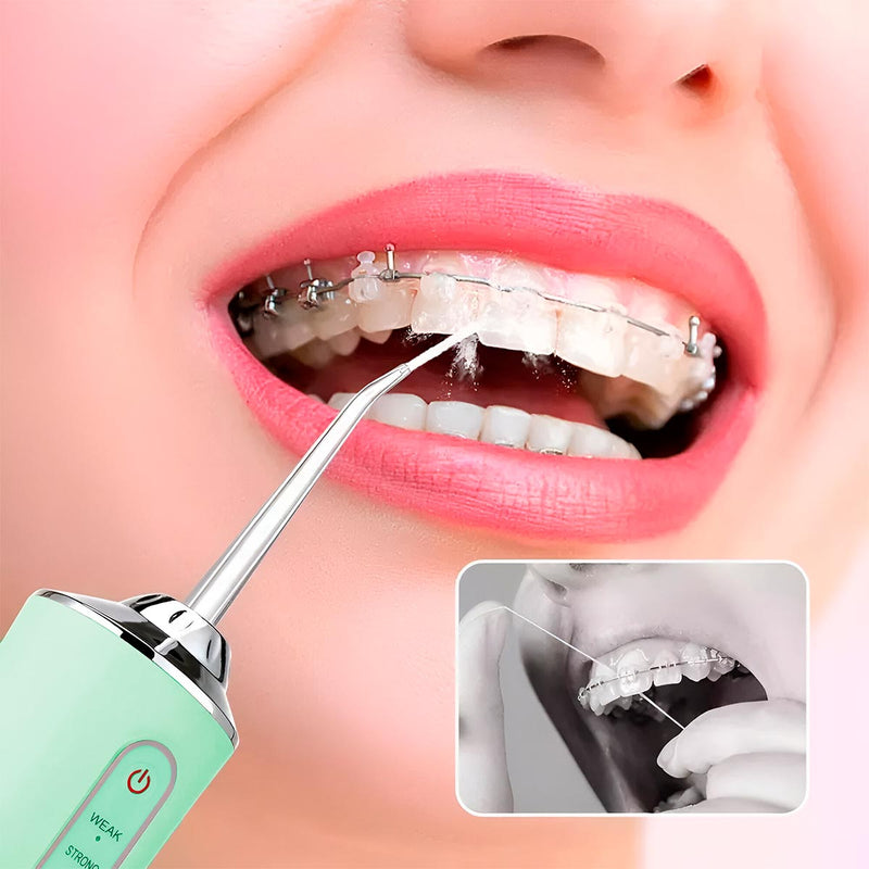 Irrigador Bucal Oral + 4 Boquillas Limpieza Dental Recargable USB KRD-1948