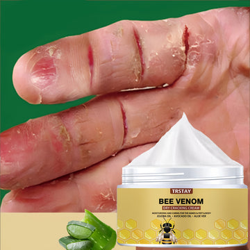 Crema hidratante con veneno de abeja Trstay - Humectante natural para piel seca y agrietada, todo tipo de piel, sin alcohol, sin fragancia, con ácido hialurónico, crema para el cuidado de la piel|Diseño de panal|Textura suave, cuidado hidratante
