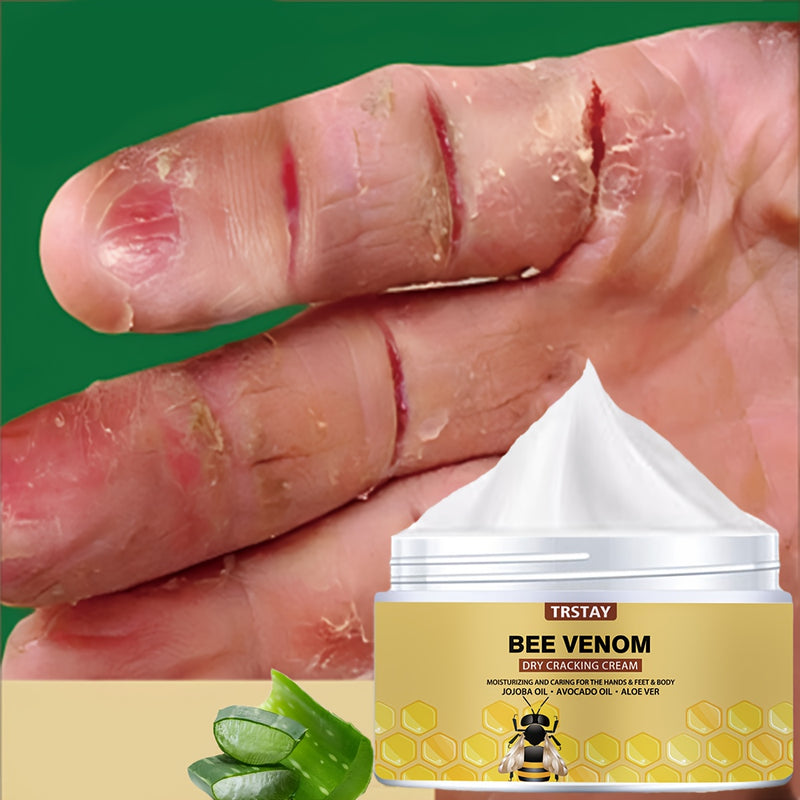 Crema hidratante con veneno de abeja Trstay - Humectante natural para piel seca y agrietada, todo tipo de piel, sin alcohol, sin fragancia, con ácido hialurónico, crema para el cuidado de la piel|Diseño de panal|Textura suave, cuidado hidratante