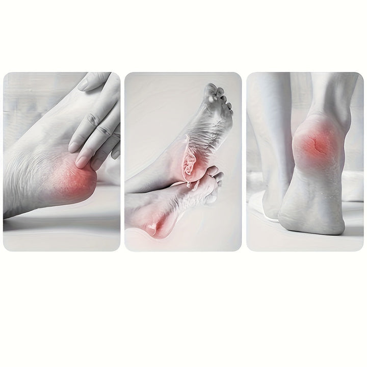 Lijadora de pies de acero inoxidable con caja de almacenamiento de piel muerta - Herramienta profesional de pedicura para eliminar la piel muerta en los pies, cortadores