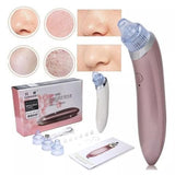 Extractor de espinillas y puntos negros (Recargable)